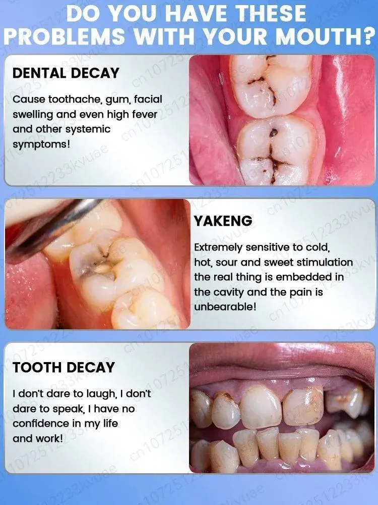 Toothpaste The Complete Family Dental Care Solution