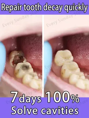 Toothpaste The Complete Family Dental Care Solution